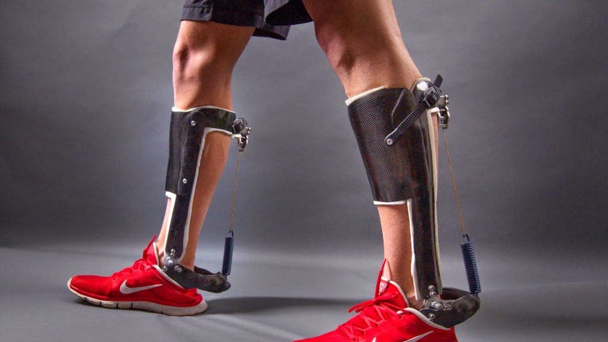 Knee pain? Achy joints? Passive bionic devices are coming